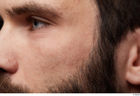  HD Face Skin Owen Reid bearded cheek eye face skin pores skin texture wrinkles 0001.jpg